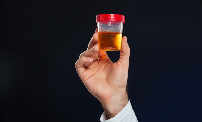 Red Flags of Blood in Urine: Understanding Hematuria and Its Causes”