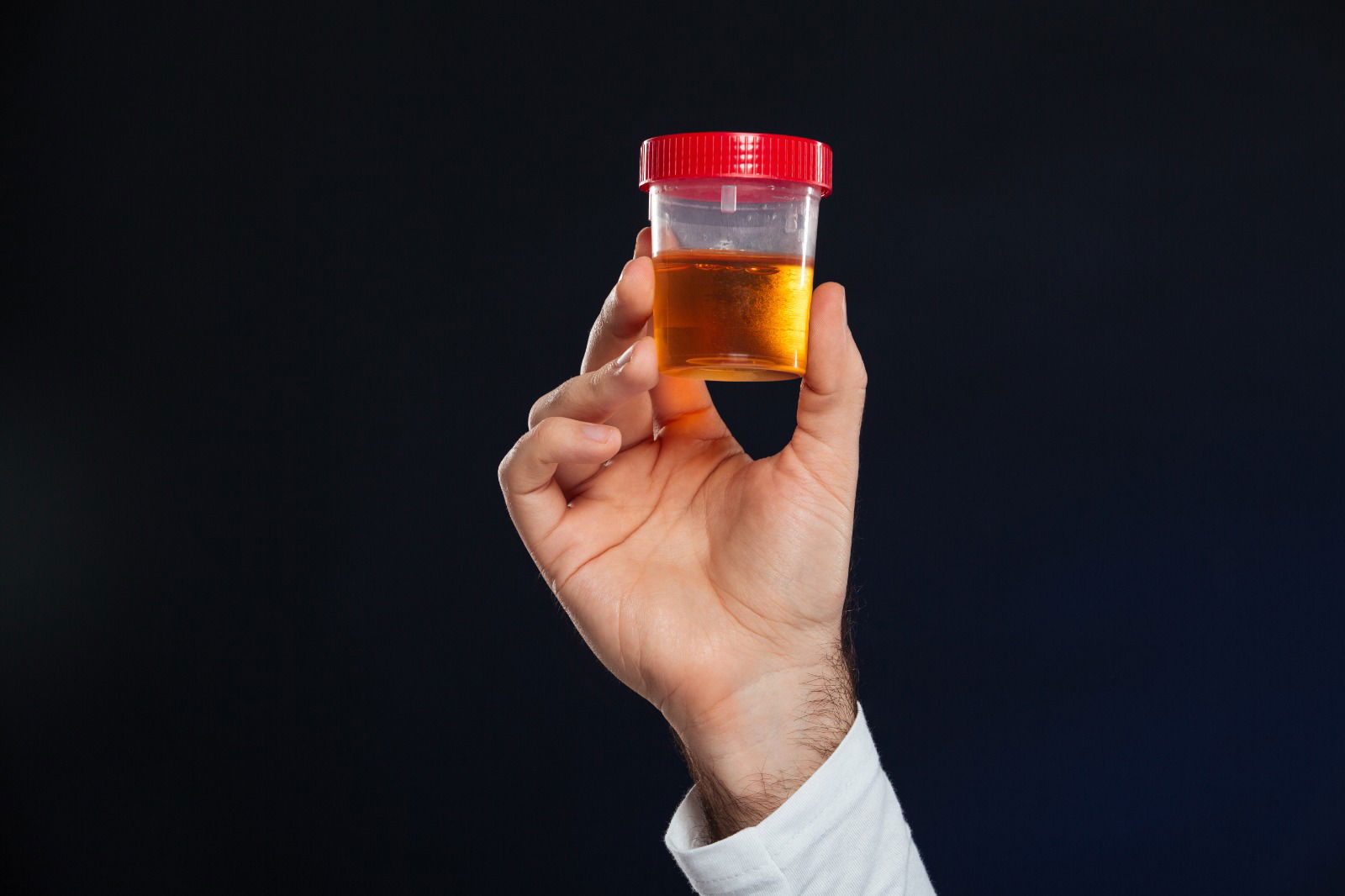 Red Flags of Blood in Urine: Understanding Hematuria and Its Causes”